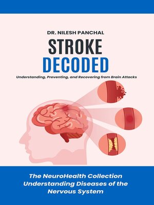 cover image of Stroke Decoded